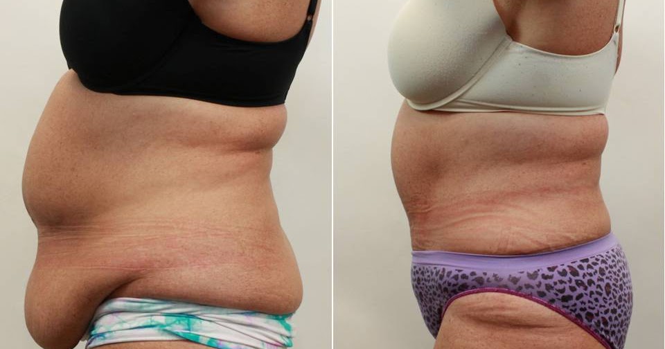 Weight loss programs in columbus georgia image 2