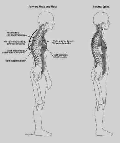 Powięź piersiowo-lędźwiowa – orlimed rehabilitacja Joga a wady postawy - plecy okrągłe. | BEYOGA