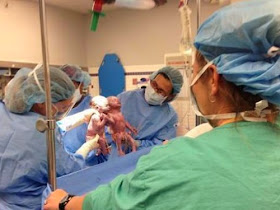 Bayi kembar ini berpegangan tangan saat saat dilahirkan (foto Viva/facebook)