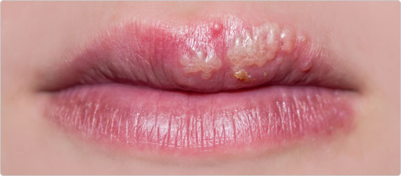 kurdzanist blogspot com