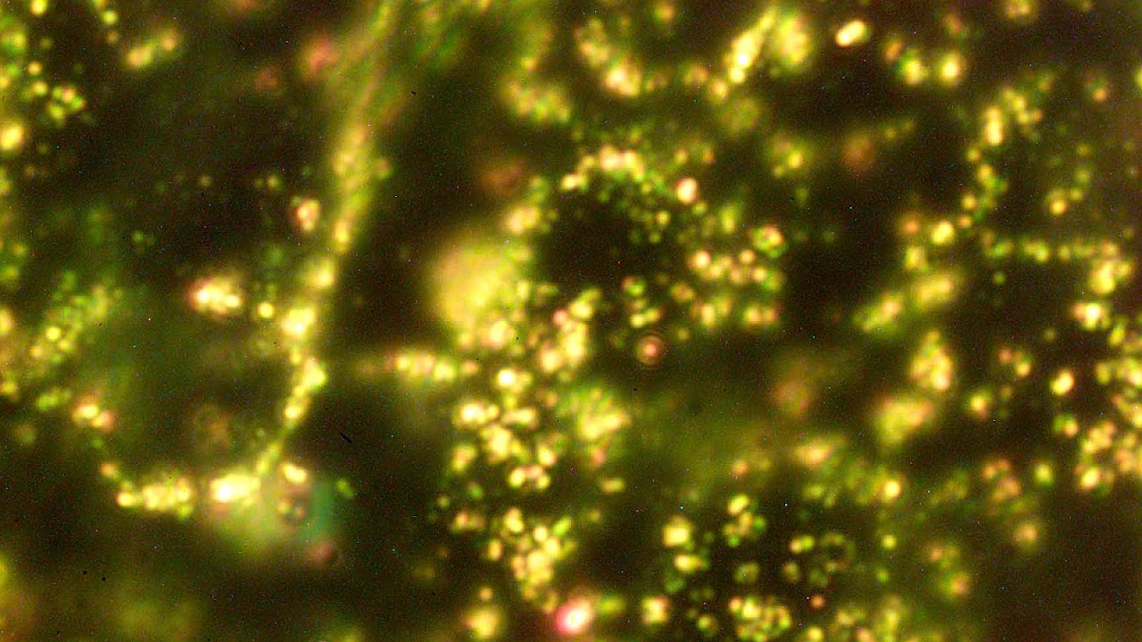 Colloidal gold Gold Nanoparticles Gold Choices