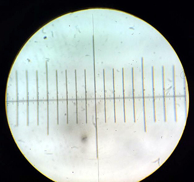IBG Lab Report LAB 2 MEASUREMENT AND COUNTING OF CELLS USING MICROSCOPE