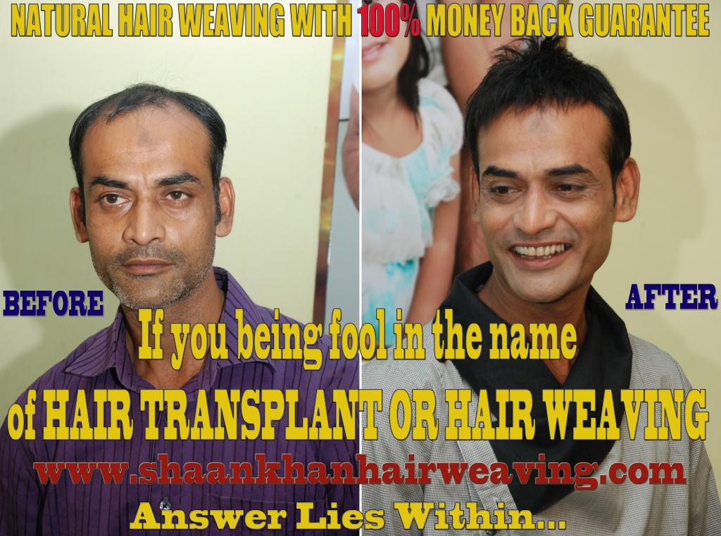 Hair Expert in Kolkata, Shaan Khan About Hair Weaving Shaan Khan