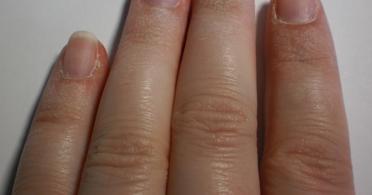 Klainer Blog: Update: essence better than gel nails