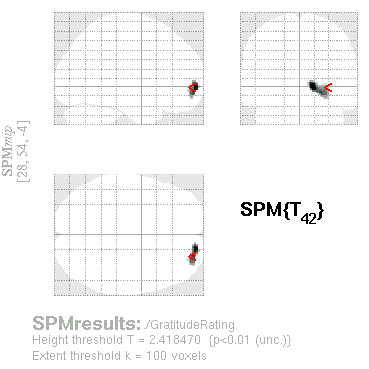 Andy S Brain Blog Parametric Modulation With Spm Why Order