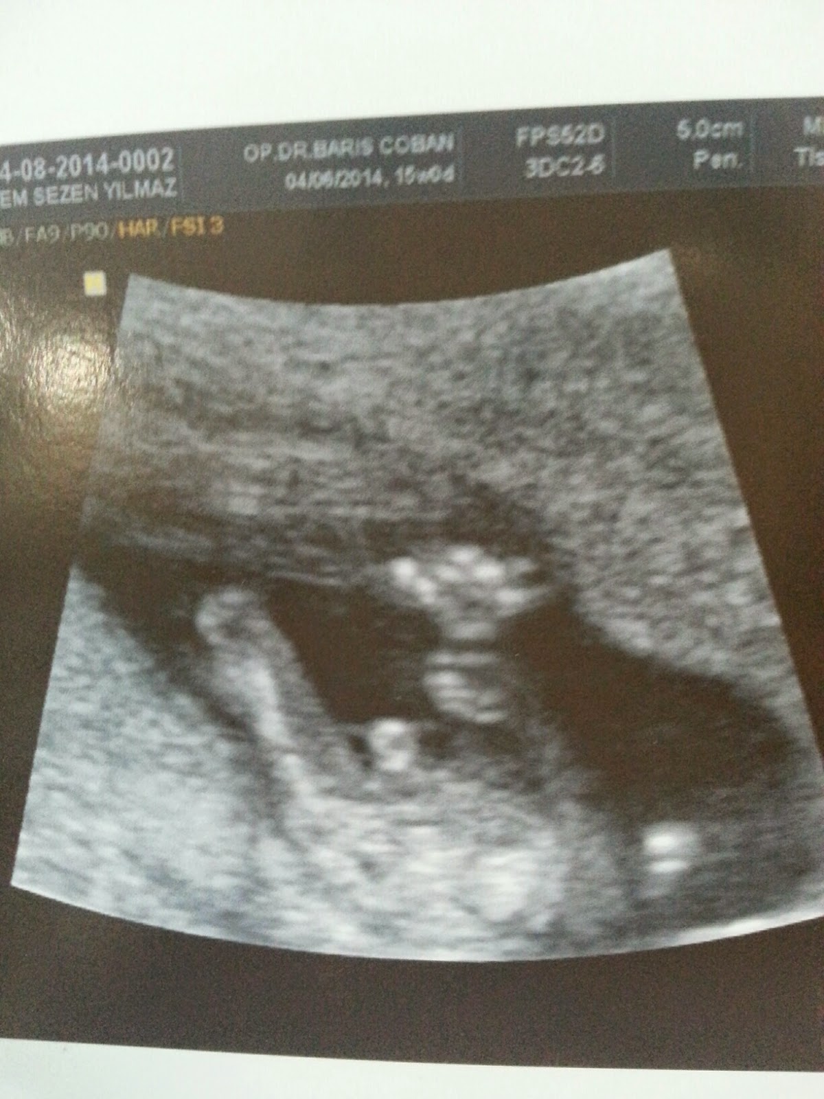 Yollarda Hayat Var… SEVGİLİ GÜNLÜK / Bebeğimin cinsiyeti Yollarda Hayat Var… SEVGİLİ GÜNLÜK / Bebeğimin cinsiyeti