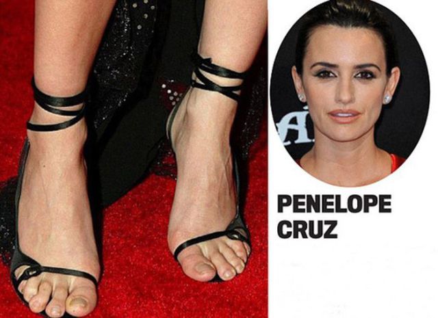 Beautiful Celebrities With Ugly Feet - FunnyMadWorld
