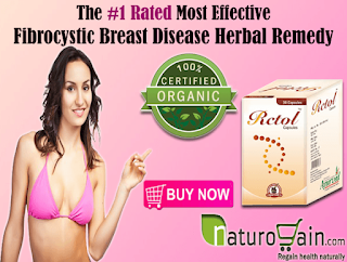 Fibrocystic Breast Disease Natural Remedies