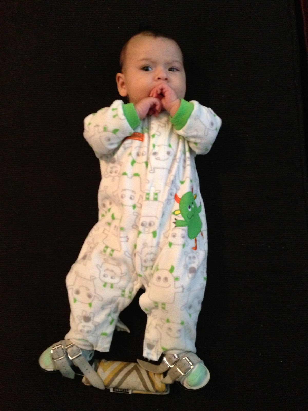 a peachtree city life Clubfoot Files Baby Gear for 23/7 Brace Wear