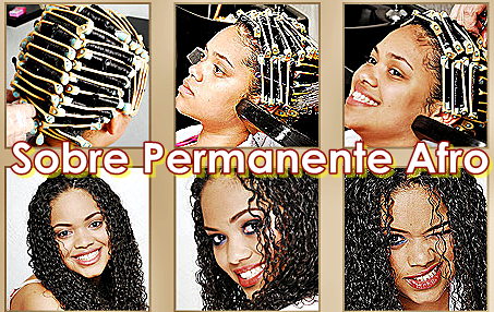 Pigmentary branco nota em crianças da razão