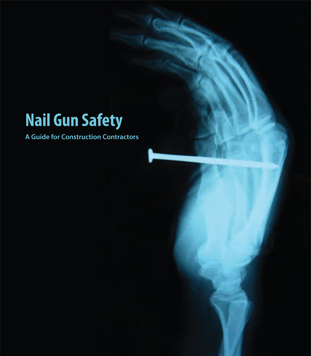 Wisconsin Building Supply News & Marketplace Nail Gun Safety A Guide