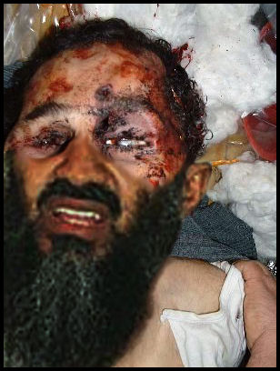 in laden dialysis was made. in laden dialysis was made. in laden dialysis was made.