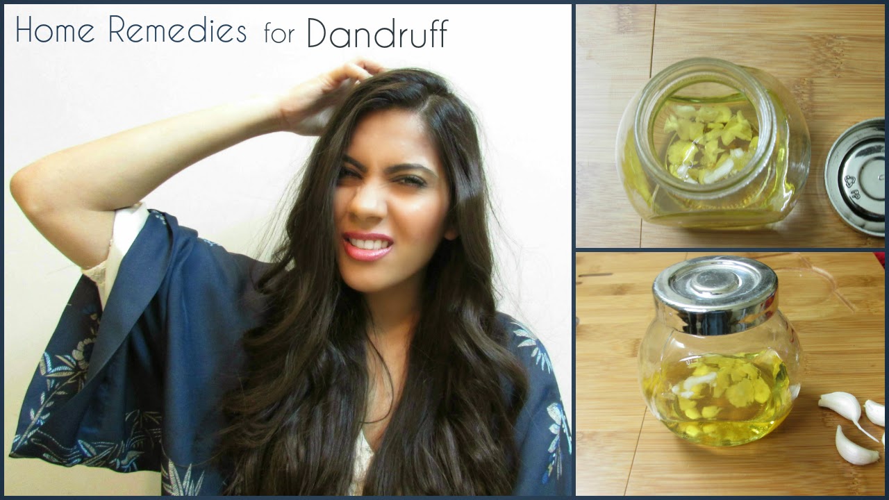 Home Remedies for Dandruff