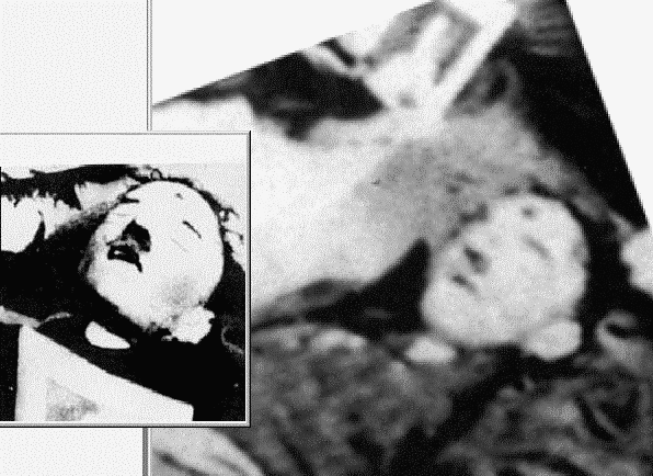A e ka vrarë vërtet veten Hitleri? Bodies