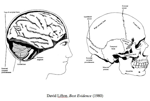 cerebellum+location.jpg