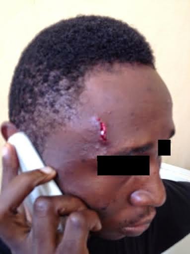 1 UNICAL Economics Lecturer Allegedly Stabs Student In The Eye