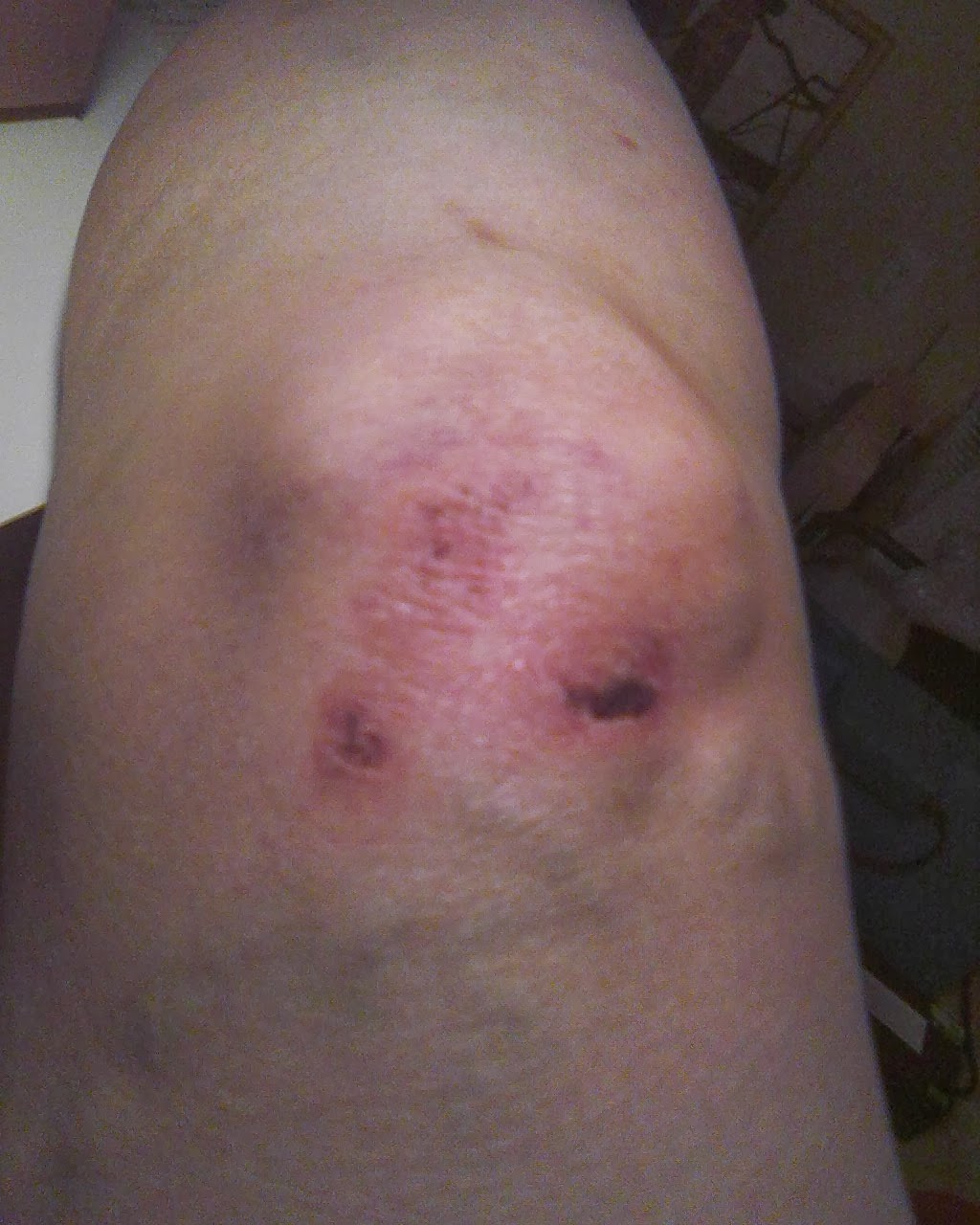 How to Make a Magical Wound Spritz