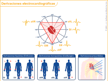 Derivaciones del EKG