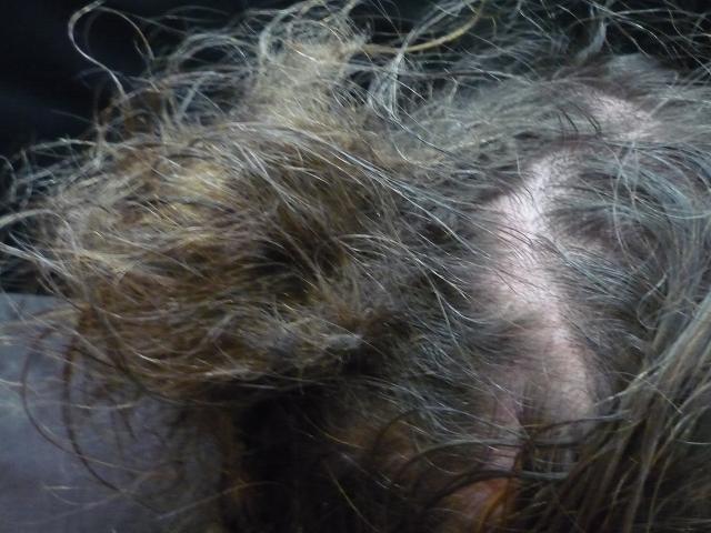 How To Get Matted Knot Out Of Hair 28 Images Hair Knot How To