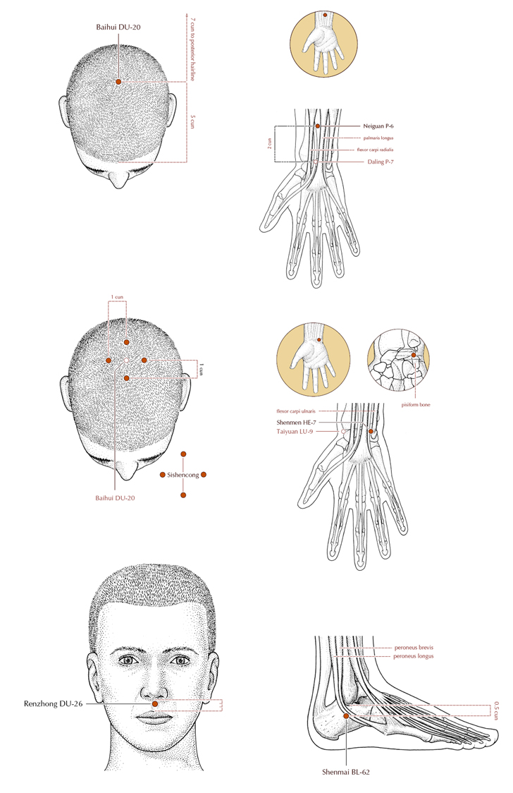 Acupuncture Masters Acupuncture Point Location for Epilepsy