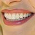 Evite Gingivitis Junto con la atención normal de los chequeos dentales, así como un cepillo de dientes eléctrico