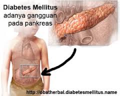 Obat yang Paling Ampuh Menyembuhkan Diabetes Melitus Obat yang Paling Ampuh Menyembuhkan Diabetes Melitus