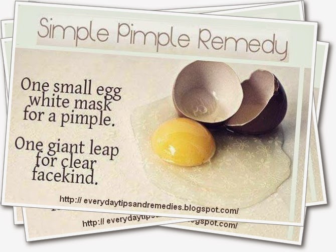 Tips And Remedies Pimple Remedy