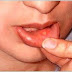  وصفة الدكتور جمال الصقلي للتخلص من مشاكل اللثة و الفم