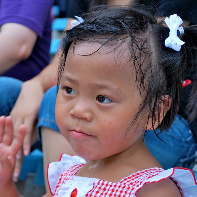 Bring my sons from afar... Before and After Tongue Reduction Surgery
