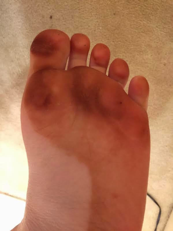 Spray Tanning Versa Vs Mystic Hel On Heels