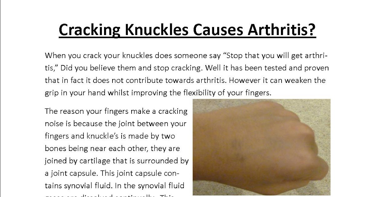 The West Bridgford School Report Does Cracking Knuckles Causes Arthritis