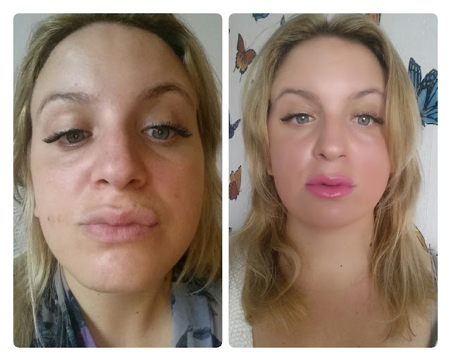 Beauty and the Blogger Microdermabrasion Facial at Pure Clinic Manchester Review