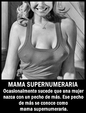 curiosidades-pechos-mujer-supernumerarios