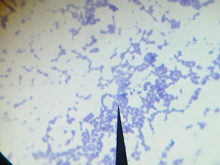 b subtilis endospore stain b subtilis endospore stain