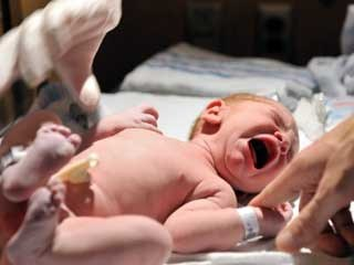 Hukum Khitan bagi Wanita