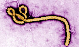 Ebola%2Bvirus