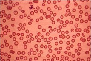 GAMAPENTA.BLOGSPOT.COM: Sel Darah Merah