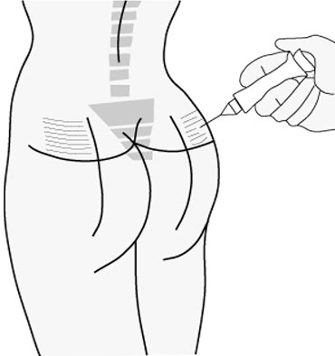 Inyeccion de esteroides para musculos