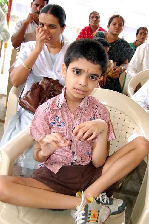 Indian Handicapped Child
