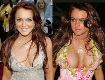 Celebrity Plastic Surgery on Hollywood Celebrity   Plastic Surgery   Bollywood Movie Photos And