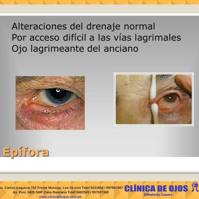 Clínica de Ojos Oftalmic Láser EPÍFORA