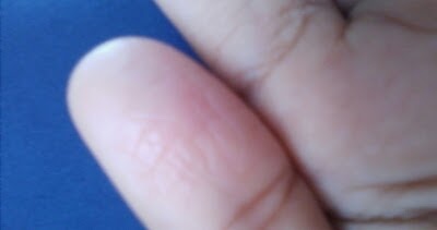 44+ Ibu Jari Rosak Gif