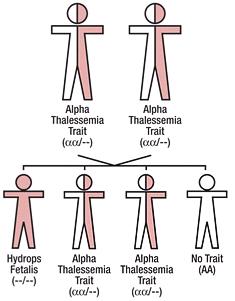 Alpha Thalassemia Symptoms