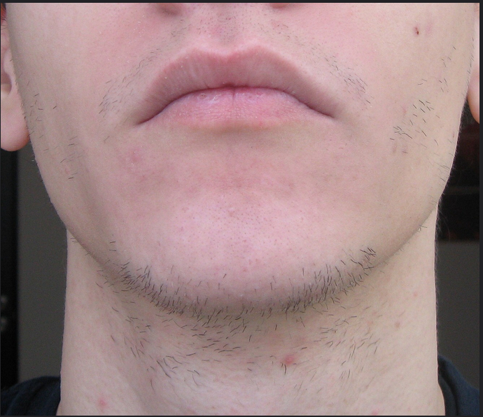 Comment Faire Pousser Sa Barbe Comment Faire Pousser La Barbe