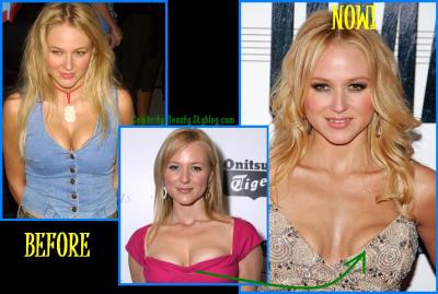 Celebrity Breasts on And After Breast Implants   Celebrity Plastic Surgery Before And After