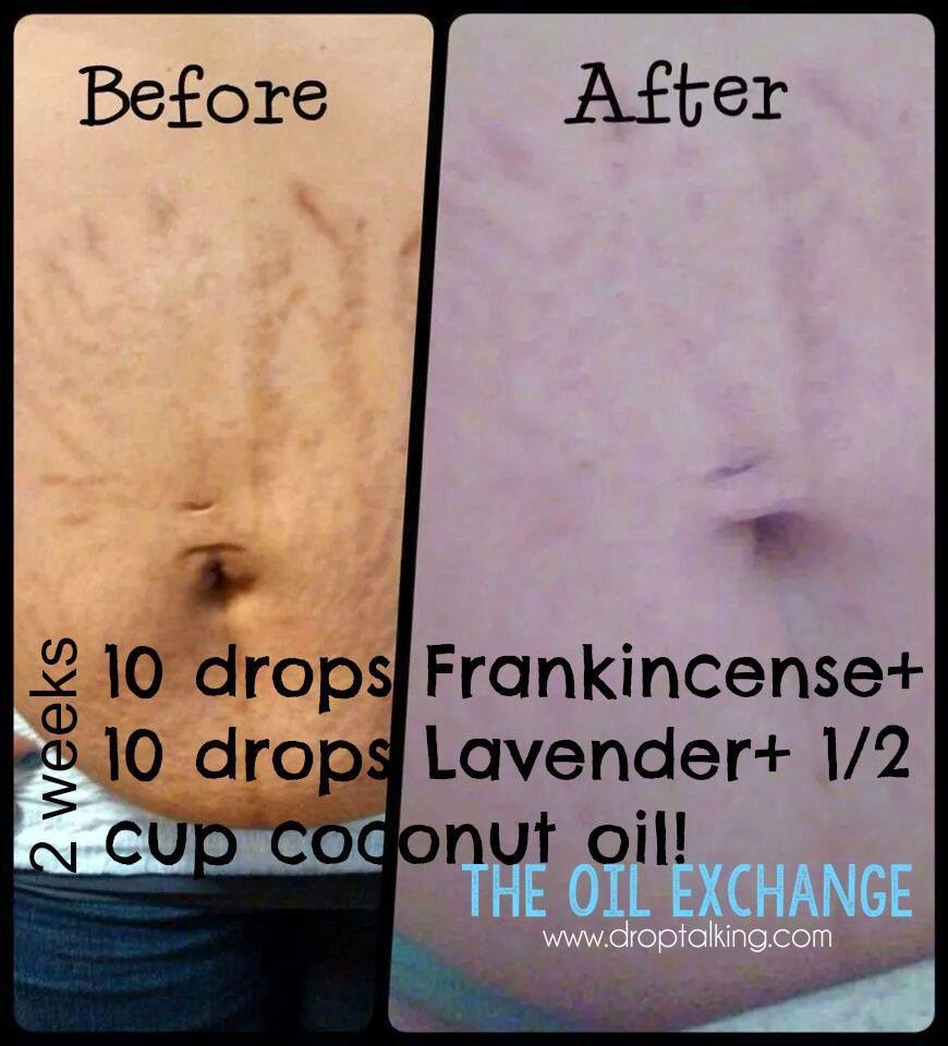 frankincense oil for skin before and after｜TikTok Search
