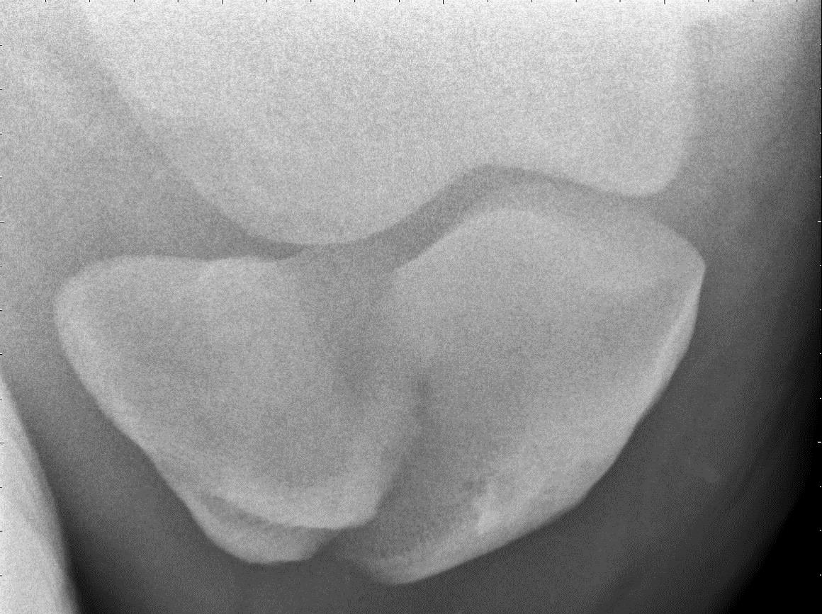 Michael Porter, Equine Veterinarian Fractured Patella in a Horse