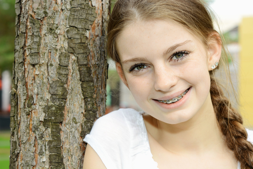 Diamond Braces If You Are Asking Yourself How Much Do Braces Cost?