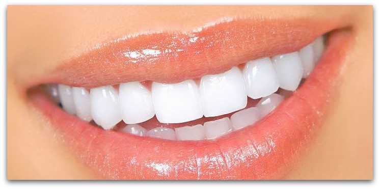 Wisdom Teeth Extraction Wisdom Teeth Extraction