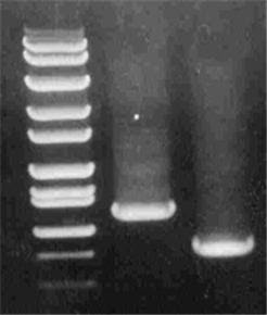 isolation pcr amplification teaching plasmid kit biosciences lysis alkaline dna biotechnology genetics